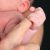 How to manage your baby’s newborn rash